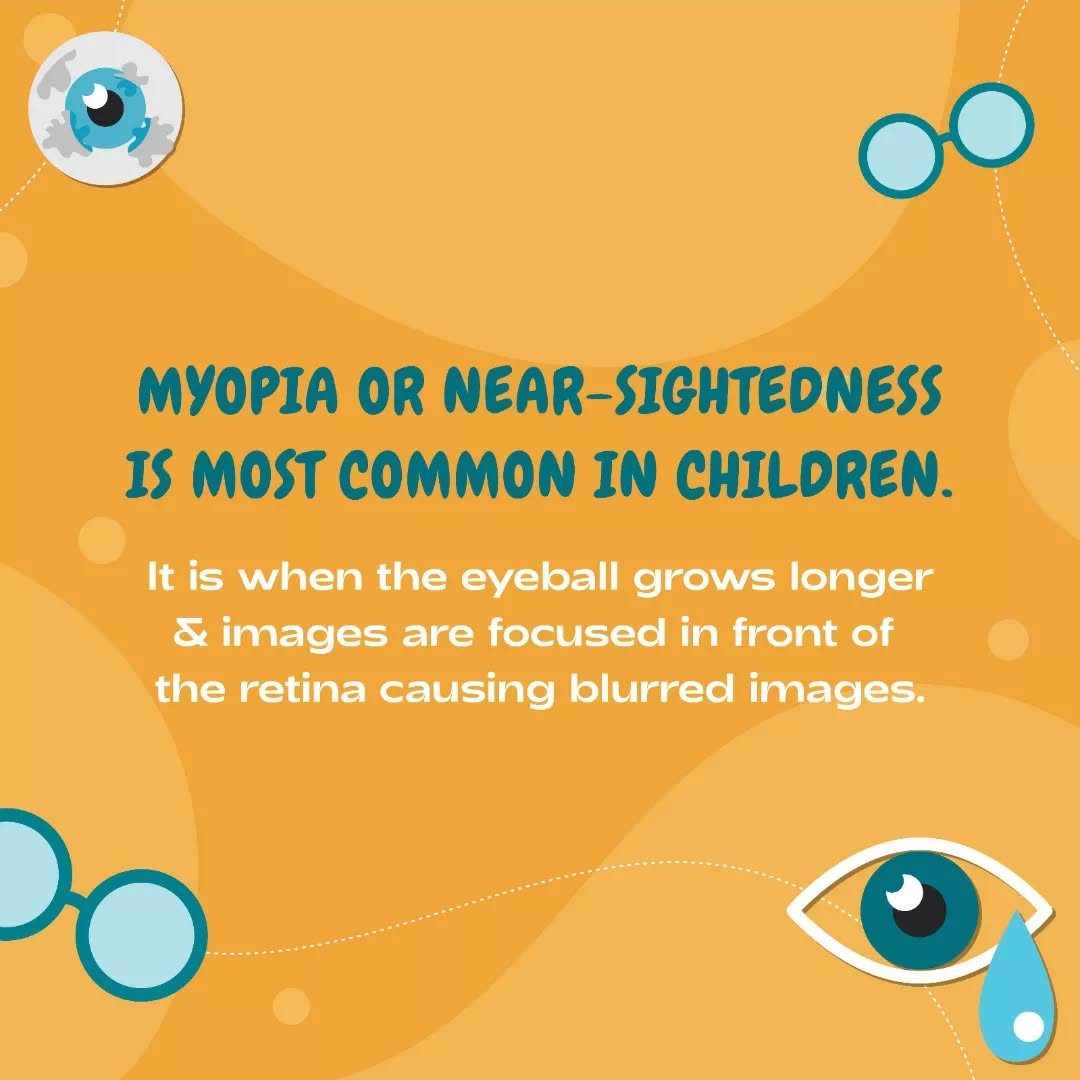 Sheth Opticals,  myopia., glasses, spectacles, sunglasses, frames, opticals, opticianahmedabad, eyewear, luxuryeyewear